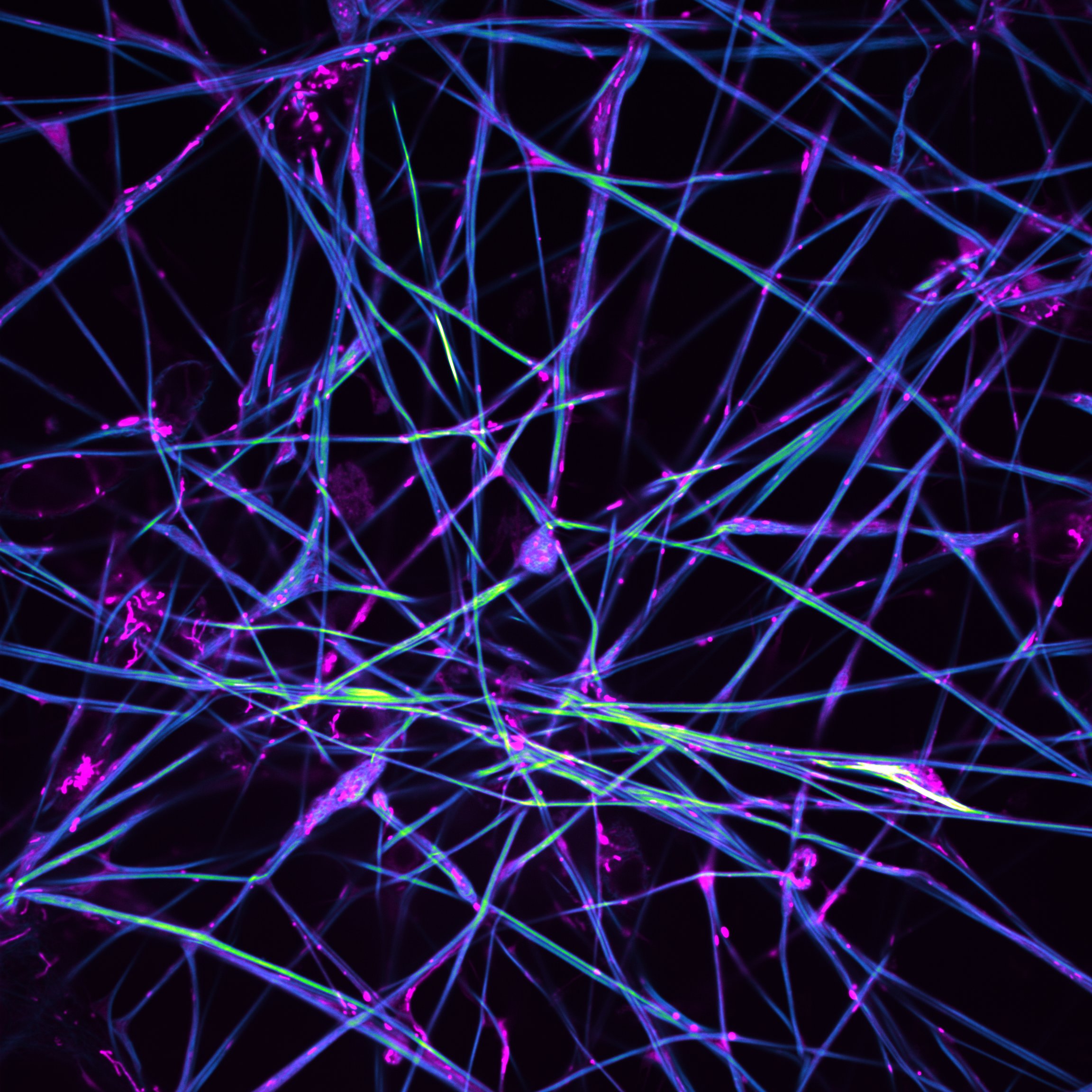 Fluorescence micrograph of culture of iPSC-derived neuronal cells